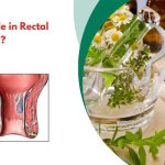 Is Surgery Avoidable in Rectal Prolapse Treatment - Consult Health Specialists