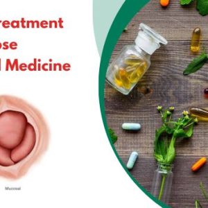 Non Surgical Treatment of Rectal Prolapse Through Herbal Medicine - Consult Health Specialists